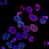 national-cancer-institute-L7en7Lb-Ovc-unsplash
